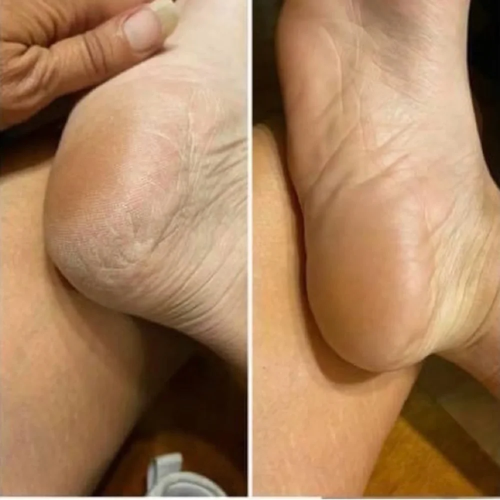 Pedicure in a bottle - Picture 8 of 9